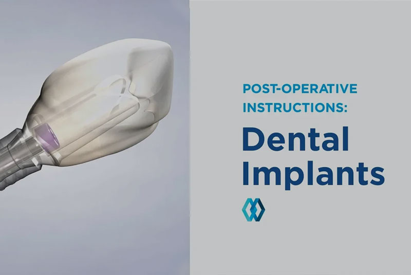 post operative dental implants instructiveg raphic